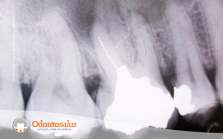 01ritrattamento-prima