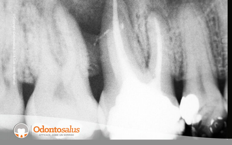 02ritrattamento-dopo