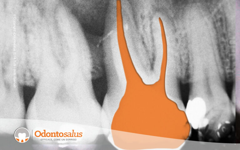 03ritrattamento-dopo-evidenziato