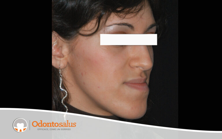 03situazione-iniziale-tre-quarti