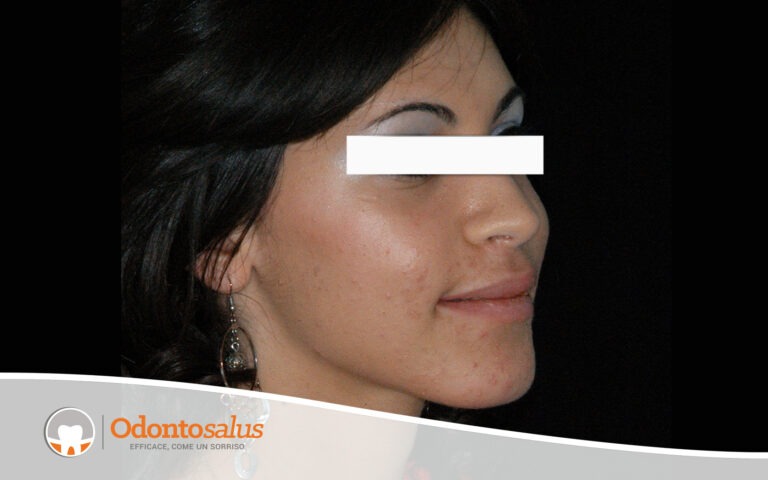 04risultato-finale-tre-quarti