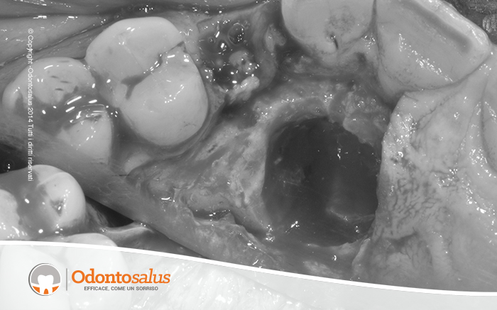 04sito-post-estrattivo1