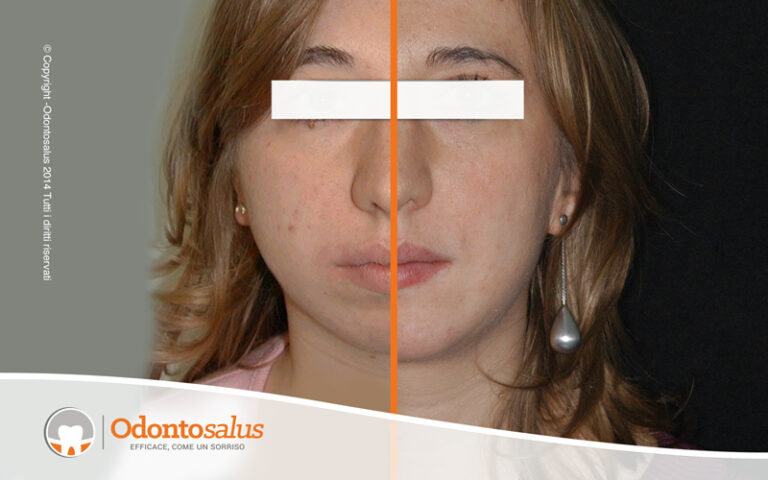 05ragazza-mento-prima-e-dopo