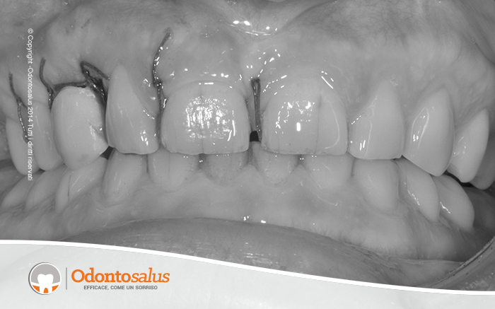 07applicaz-provvisorio