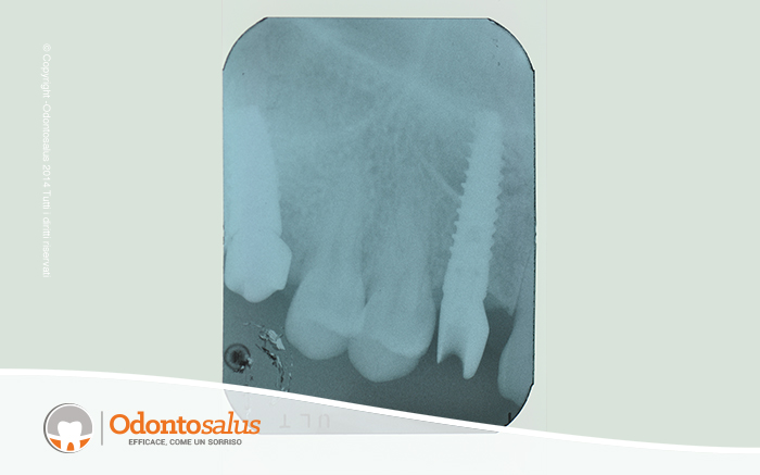 08controllo-radiografico