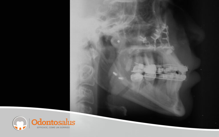 10controllo-radiografico