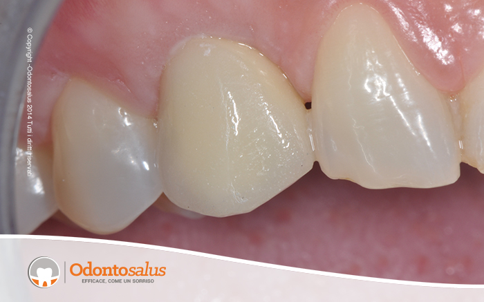 10dettaglio-elemento-definitivo