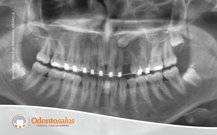 agganciocaninoincluso01