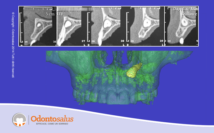 agganciocaninoincluso02