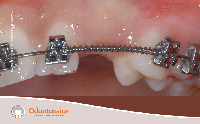 agganciocaninoincluso04