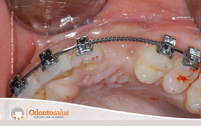 agganciocaninoincluso05